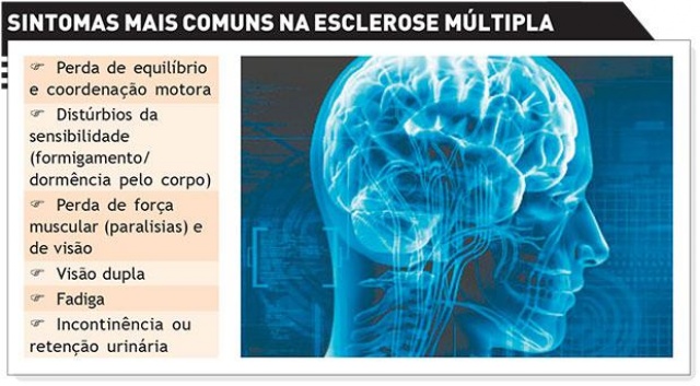  Mais da metade dos paulistanos não sabe a principal faixa etária diagnosticada com Esclerose Múltipla