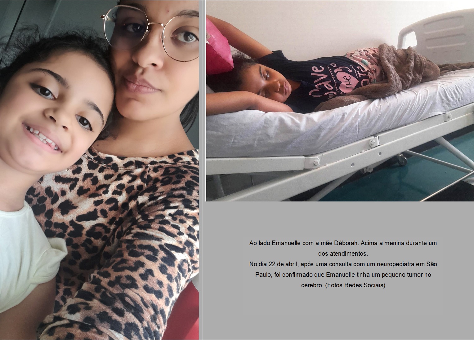 Todos por Emanuelle: Campanha arrecada fundos para tratamento de menina de 9 anos com tumor cerebral em Garça 